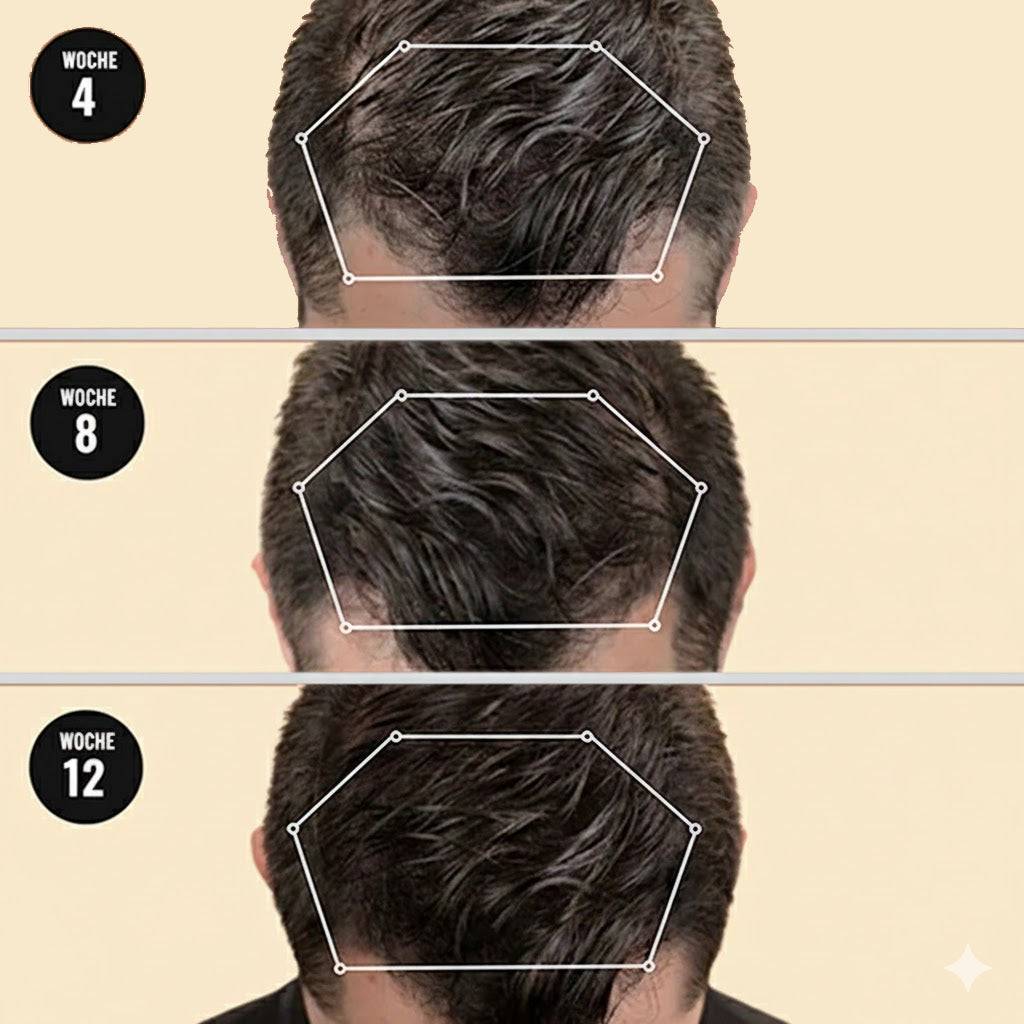 Root Activator Shampoo